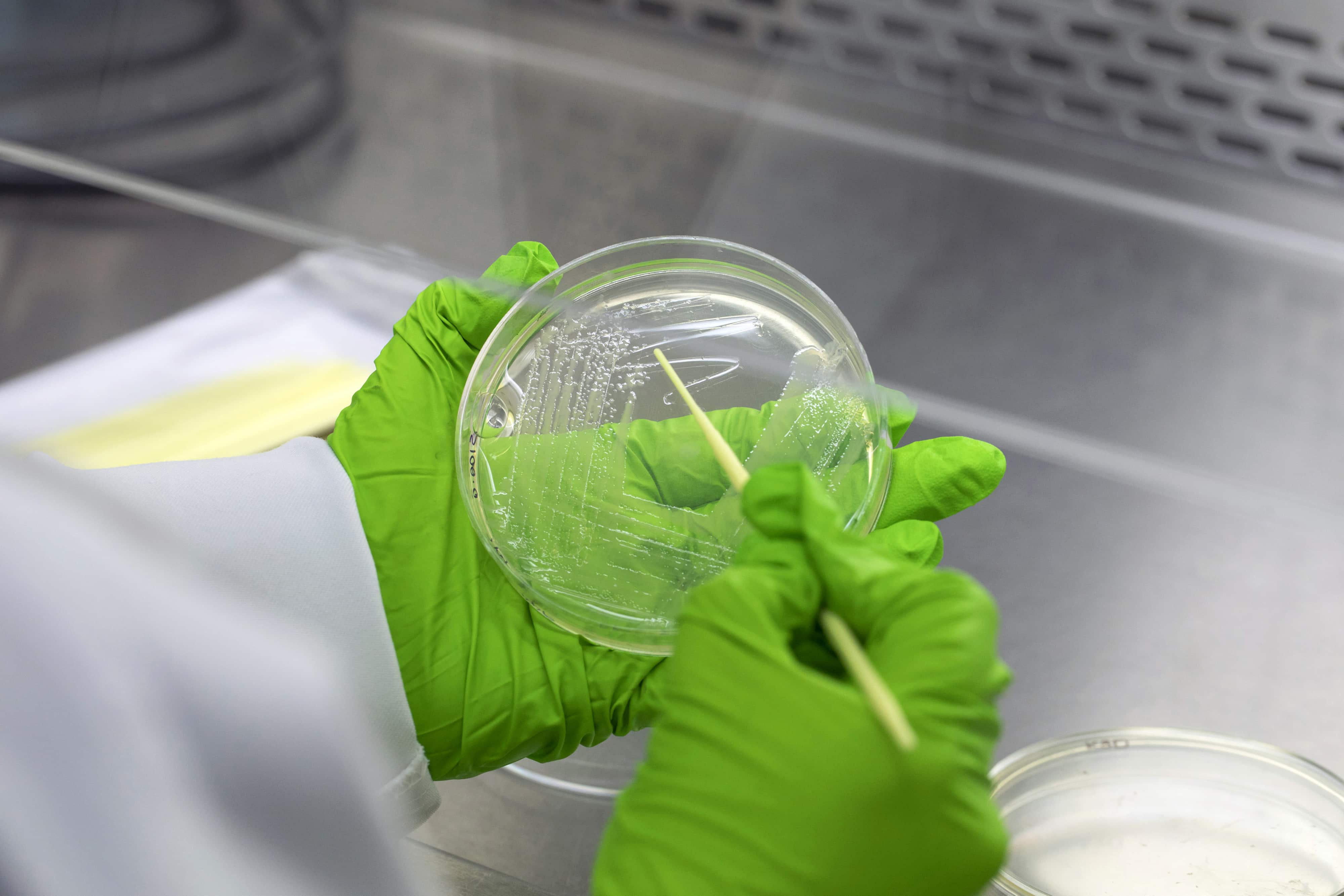 UK Health Official: Antimicrobial-Resistant Bacteria Could Kill 40M by 2050