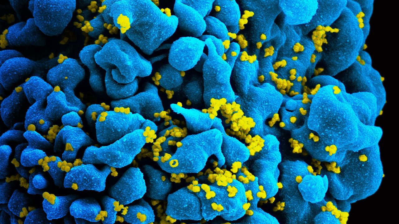 Study: mRNA Forces Hidden HIV Out of Cells