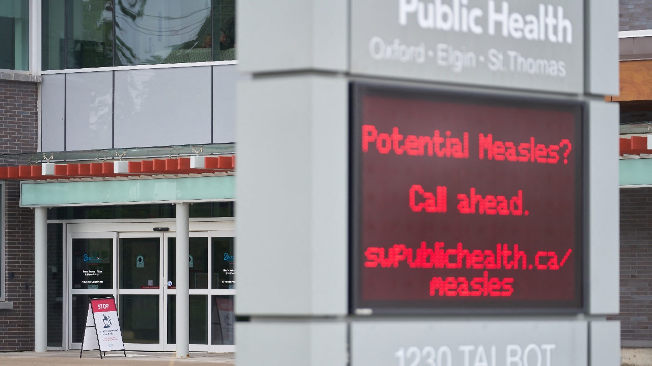 Canada Loses Measles-Free Status After 27 Years